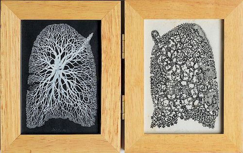 ARIC OBOSEY: LACE LUNGS