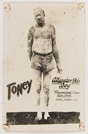 Toney Alligator Skin Boy Sideshow Cabinet Card.