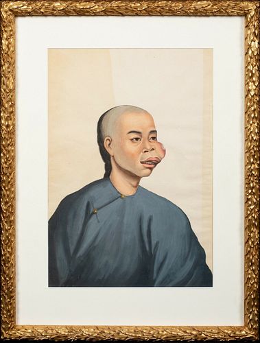 CHINESE CANCER PATIENT PORTRAIT OIL PAINTING