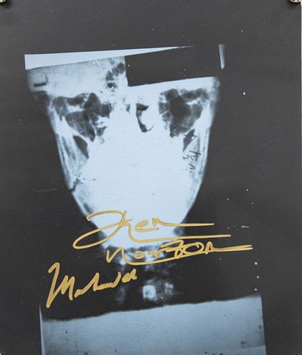 Broken Jaw X-Ray Autographed by Norton &  Ali