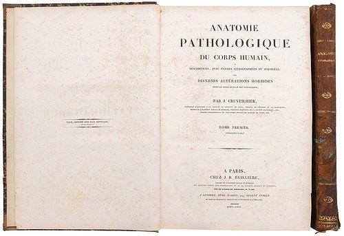 Cruveilhier, Jean Anatomie Pathologique du Corps Humain. Paris: Baillière, 1829 - 1835. Tomo I en dos vols. 118 litografías. Pzas: 2.