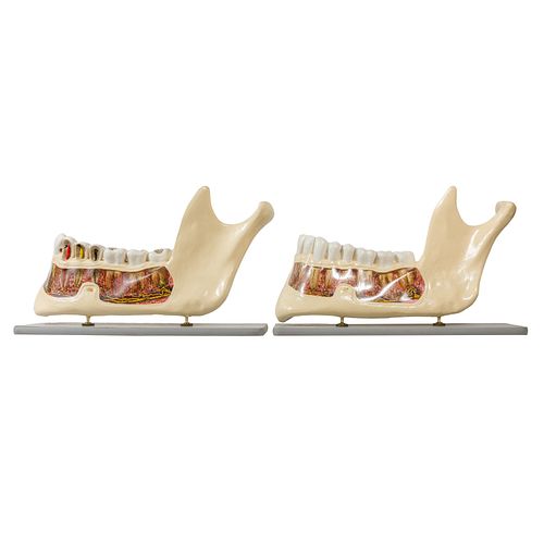 Two Large Lower Jaw & Teeth Models