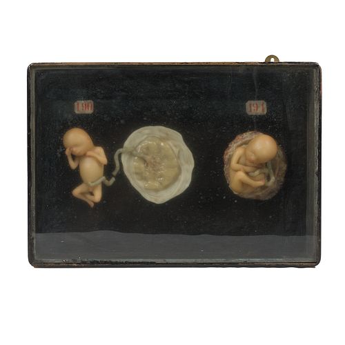 19th Century Wax Models, Fetuses
