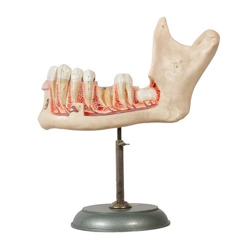 Somso Anatomical Model of the Lower Jaw