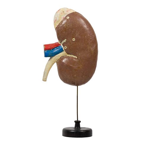 Anatomical Model of a Kidney, Dr. Auzoux