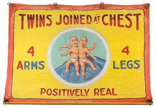 Fred Johnson, (American, 1892-1990), Twins Joined at Chest, c. 1960's