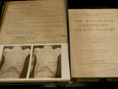 The Edinburgh Stereoscopic Atlas of Anatomy, 1905, comprising five cases of two hundred and fifty bl