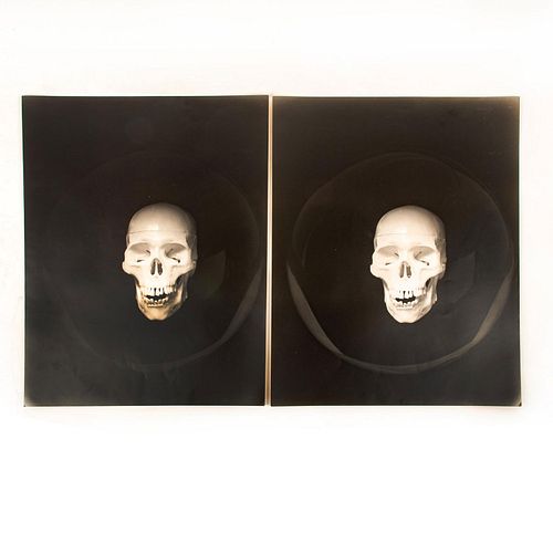 Gelatin Silver Print, The Human Skull, 2 Prints