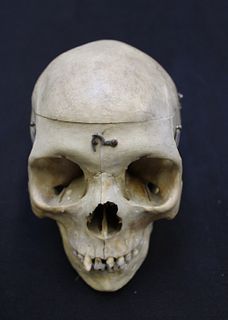 Antique Medical Skull With Lateral Split