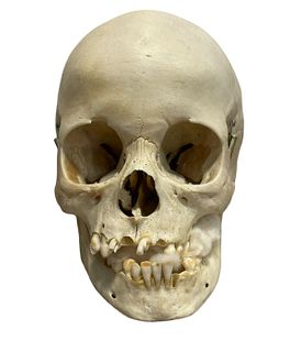 Small Medical Skull in case 