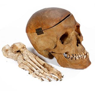 Antique Medical/Dental Student's Teaching Skull