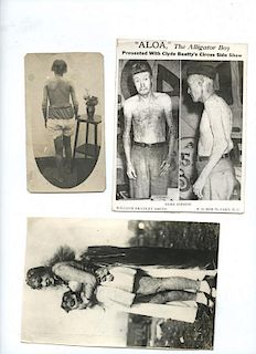 Group of Four Photos of Alligator or Elephant Skinned People.