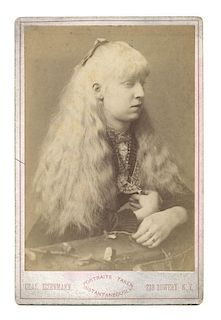 Mary McKinnon. Albino Lady Cabinet Card.