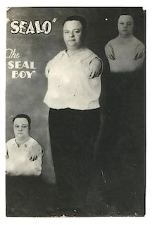 "Sealo" the Seal Boy Sideshow Photograph.