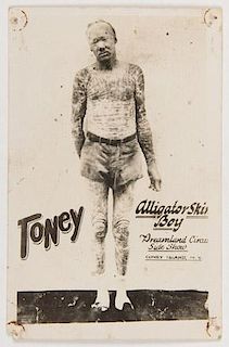 Toney Alligator Skin Boy Sideshow Cabinet Card.