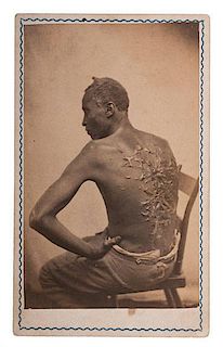 Rare CDV of the Escaped Slave "Gordon" Displaying His Scars 