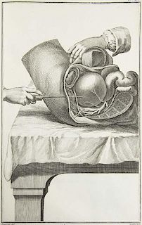 Diderot, Denis u. J. L. d'Alembert
Chirurgie. 1 gestoch. Frontispiz u. 36 Kupfertafeln von Prévost u. Defehrt nach Goussier.
