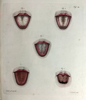 [MEDICINE] De Lingua Anatomica Quaedam et Semiotica