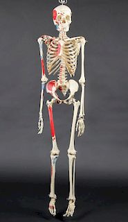 Authentic Early Medical School Female Skeleton Model