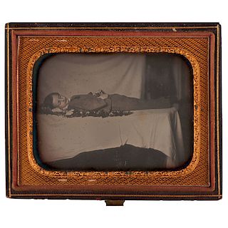 Three Postmortem Daguerreotypes Believed to Be of Same Young Boy