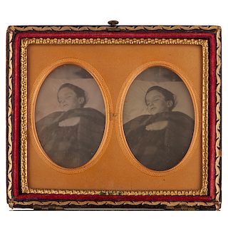 Mascher Postmortem Stereodaguerreotype of a Young Boy