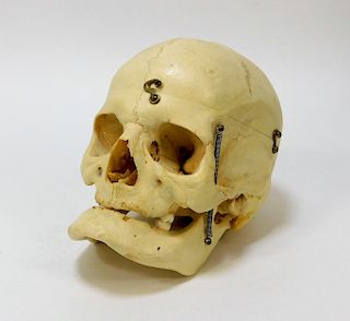 Authentic Medical Student Study Human Bone Skull