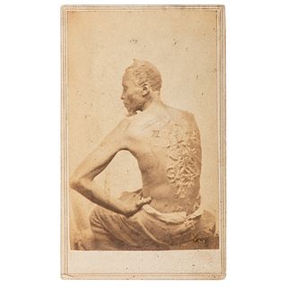 CDV of Escaped Enslaved African American "Gordon" Displaying his Scars