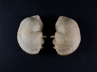Two Bone Whales Inner Ears, 19th Century