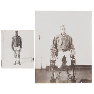 WWI African American Veteran Amputee with Prosthetic Legs, circa 1918