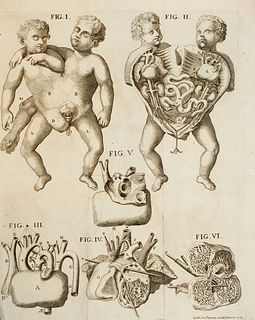 Bianchi, Giambattista Storia del mostro di due corpi, che nacque sul Pavese in Giugno 1748. Mit 2 gef. Kupfertafeln. Torino, Campana, (1749). 2 Bll., 