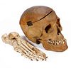 Antique Medical/Dental Student's Teaching Skull