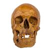 Antique Human Skull
