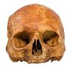 Antique Trepanated Human Skull