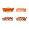 Cased Set of Antique Dentures
