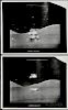 Taken by an RCA TV Camera Mounted to the Lunar Rover