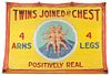 Fred Johnson, (American, 1892-1990), Twins Joined at Chest, c. 1960's