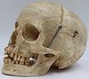 Antique Medical School Human Skull.